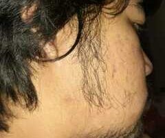 Kenapa Brewok Tidak Merata: Penyebab & Solusinya