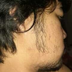 sebelum penggunaan penumbuh brewok fabron