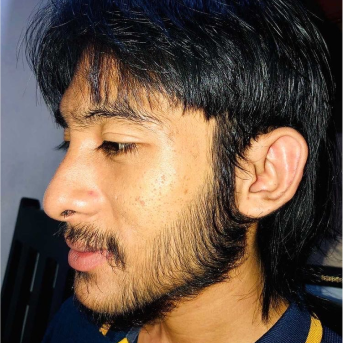 setelah pemakaian penumbuh brewok fabron