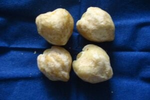 Menumbuhkan Brewok Dengan Kemiri