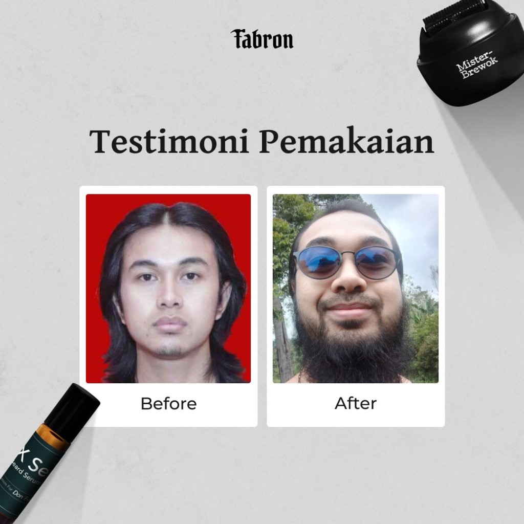 (e-voucher) Beard Warrior Package - Treatment Penumbuh Brewok - Gambar 4