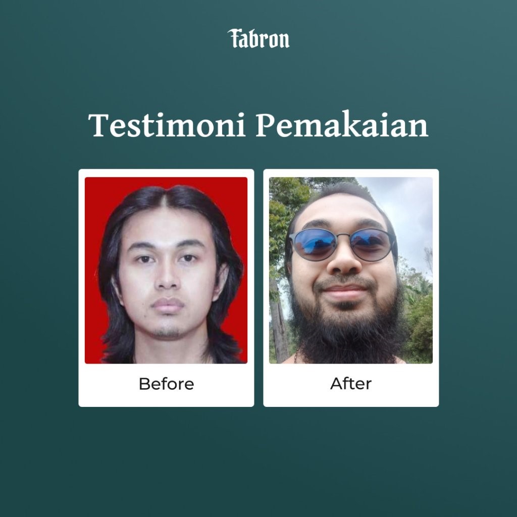 (e-voucher) X Serum - Beard Starter Treatment - Gambar 5